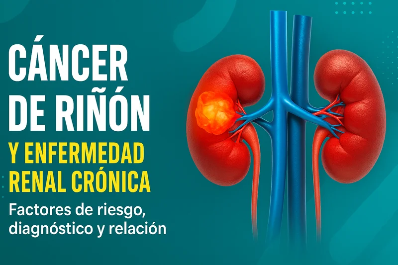 cancer rinon enfermedad renal cronica
